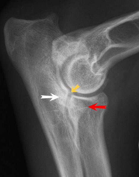 FCP in a canine elbow